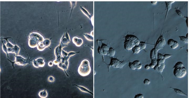 Fig. 2: HEK cells contrasted with phase contrast (left) and PlasDIC (right). C, Lücking, Institut für Neurogenetik, Klinikum Großhadern, Munich.